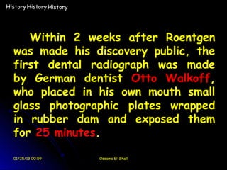 History History History




     Within 2 weeks after Roentgen
  was made his discovery public, the
  first dental radiograph was made
  by German dentist Otto Walkoff,
  who placed in his own mouth small
  glass photographic plates wrapped
  in rubber dam and exposed them
  for 25 minutes.

  01/25/13 00:59          Ossama El-Shall
 