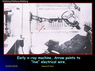 History History History




               Early x-ray machine. Arrow points to
                       “live” electrical wire.
  01/25/13 00:59            Ossama El-Shall
 