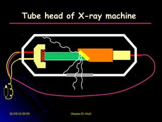 Tube head of X-ray machine




01/25/13 00:59     Ossama El-Shall
 