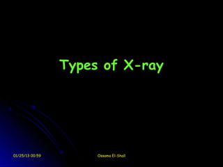 Types of X-ray




01/25/13 00:59        Ossama El-Shall
 