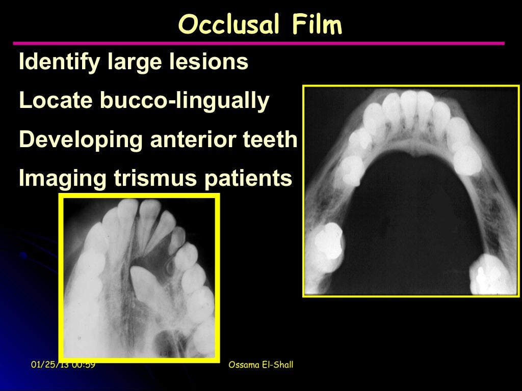 1 dental radiology