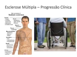 Esclerose Múltipla – Progressão Clínica
 