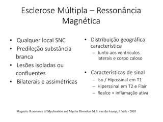 Esclerose Múltipla – Ressonância
Magnética
• Qualquer local SNC
• Predileção substância
branca
• Lesões isoladas ou
confluentes
• Bilaterais e assimétricas
• Distribuição geográfica
característica
– Junto aos ventrículos
laterais e corpo caloso
• Características de sinal
– Iso / Hipossinal em T1
– Hiperssinal em T2 e Flair
– Realce = inflamação ativa
Magnetic Resonance of Myelination and Myelin Disorders M.S. van der knaap, J. Valk - 2005
 