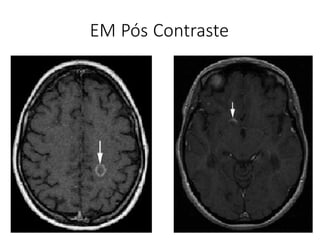 EM Pós Contraste
 