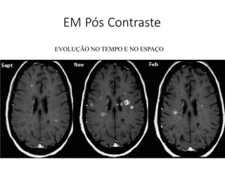 EM Pós Contraste
EVOLUÇÃO NO TEMPO E NO ESPAÇO
 