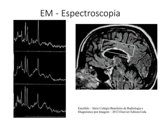 EM - Espectroscopia
Encéfalo – Série Colégio Brasileiro de Radiologia e
Diagnóstico por Imagem – 2012 Elsevier Editora Ltda
 