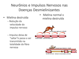 Neurônios e Impulsos Nervosos nas
Doenças Desmielinizantes
• Mielina destruída
– Redução da
velocidade do
impulso nervoso
– Impulso deixa de
“saltar”e passa a ser
transmitido na
totalidade da fibra
nervosa
• Mielina normal x
mielina destruída
 