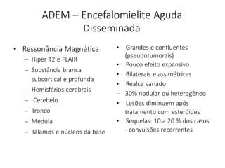 ADEM – Encefalomielite Aguda
Disseminada
• Ressonância Magnética
– Hiper T2 e FLAIR
– Substância branca
subcortical e profunda
– Hemisférios cerebrais
– Cerebelo
– Tronco
– Medula
– Tálamos e núcleos da base
• Grandes e confluentes
(pseudotumorais)
• Pouco efeito expansivo
• Bilaterais e assimétricas
• Realce variado
– 30% nodular ou heterogêneo
• Lesões diminuem após
tratamento com esteróides
• Sequelas: 10 a 20 % dos casos
- convulsões recorrentes
 