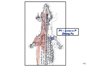 P1 –P1 – ALARME DOALARME DO PP
Zhong FuZhong Fu
115
 