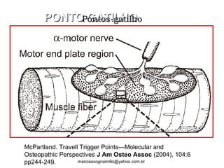 PONTO GATILHOPONTO GATILHO
McPartland. Travell Trigger Points—Molecular and
Osteopathic Perspectives J Am Osteo Assoc (2004), 104:6
pp244-249.
Pontos-gatilhoPontos-gatilho
marciascognamillo@yahoo.com.br
 