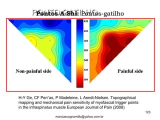 H-Y Ge, CF Pen˜as, P Madeleine, L Aendt-Nielsen. Topographical
mapping and mechanical pain sensitivity of myofascial trigger points
in the infraspinatus muscle European Journal of Pain (2008)
PONTO GATILHOPONTO GATILHOPontos A-Shi:Pontos A-Shi: Pontos-gatilhoPontos-gatilho
123
marciascognamillo@yahoo.com.br
 