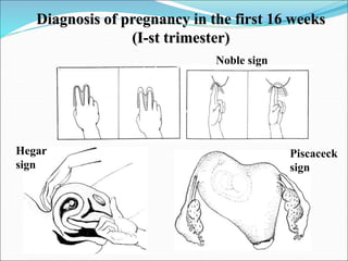 1-diagnosis-of-pregnancy.ppt