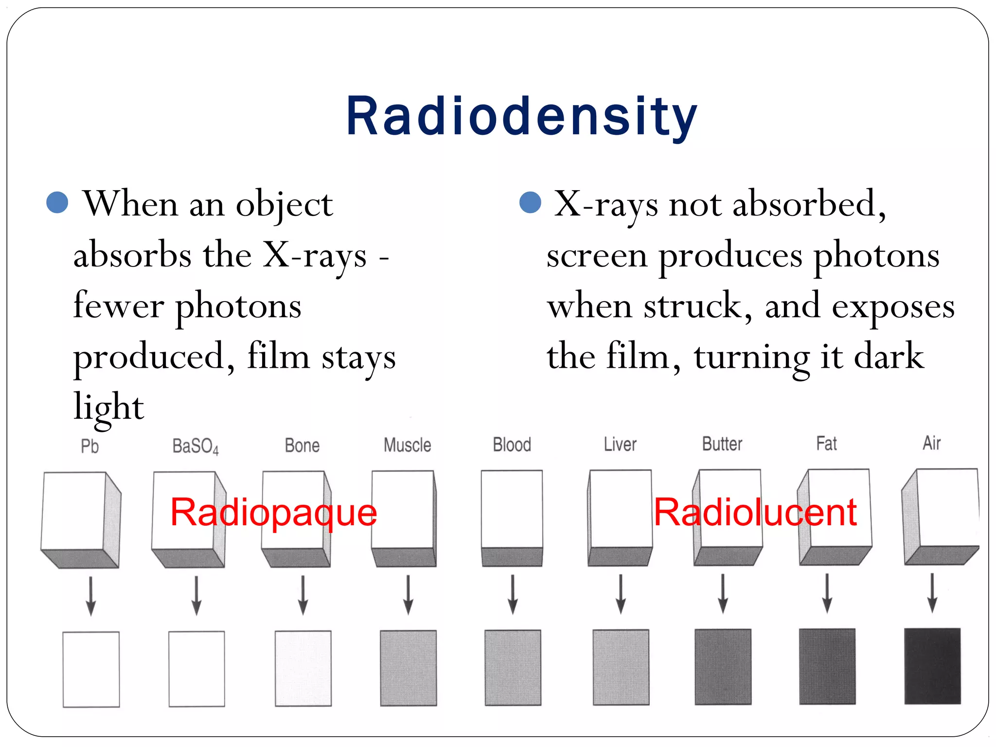 Radiodensity
X-rays not absorbed,
screen produces photons
when struck, and exposes
the film, turning it dark
When an object
absorbs the X-rays -
fewer photons
produced, film stays
light
Radiopaque Radiolucent
 