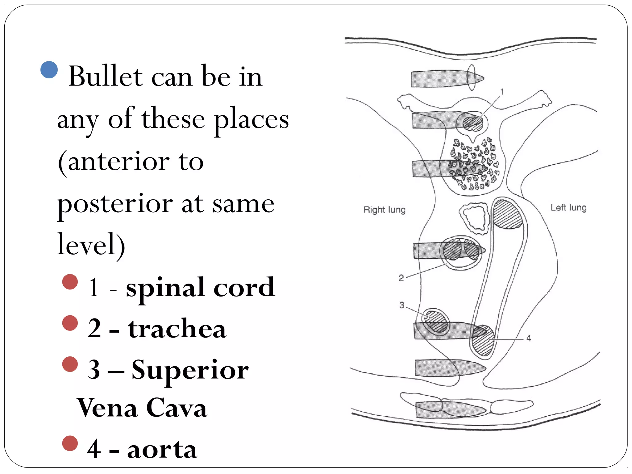 Bullet can be in
any of these places
(anterior to
posterior at same
level)
1 - spinal cord
2 - trachea
3 – Superior
Vena Cava
4 - aorta
 
