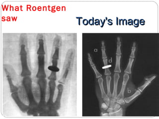 What Roentgen
saw Today's ImageToday's Image
 