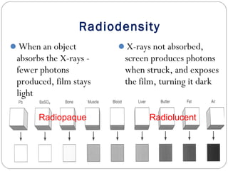 Radiodensity
X-rays not absorbed,
screen produces photons
when struck, and exposes
the film, turning it dark
When an object
absorbs the X-rays -
fewer photons
produced, film stays
light
Radiopaque Radiolucent
 