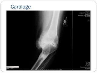 Cartilage
 
