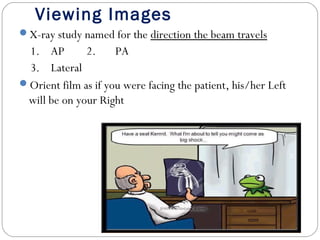 Viewing Images
X-ray study named for the direction the beam travels
1. AP 2. PA
3. Lateral
Orient film as if you were facing the patient, his/her Left
will be on your Right
 