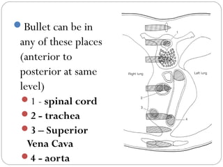 Bullet can be in
any of these places
(anterior to
posterior at same
level)
1 - spinal cord
2 - trachea
3 – Superior
Vena Cava
4 - aorta
 