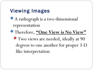 Viewing Images
A radiograph is a two dimensional
representation
Therefore, “One View is No View”
Two views are needed, ideally at 90
degress to one another for proper 3-D
like interpretation
 