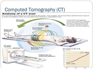 Computed Tomography (CT)
 