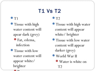 T1 Vs T2
T1
Tissue with high
water content will
apear dark (grey)
Fat, edema,
infection
Tissue with low
water content will
appear white/
brighter
T2
Tissue with high water
content will appear
white/ brighter
Tissue with low water
content will appear
darker (grey)
World War II
Water is white on
T2
 