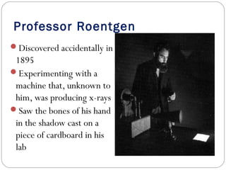 Professor Roentgen
Discovered accidentally in
1895
Experimenting with a
machine that, unknown to
him, was producing x-rays
Saw the bones of his hand
in the shadow cast on a
piece of cardboard in his
lab
 