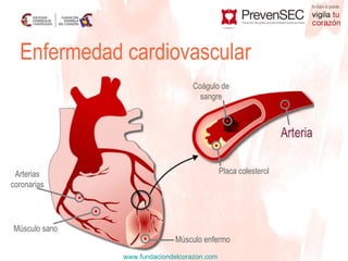 Enfermedad cardiovascular Placa colesterol Arterias coronarias Coágulo de sangre Músculo sano Músculo enfermo 