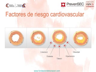 Factores de riesgo cardiovascular 