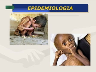 EPIDEMIOLOGIA 