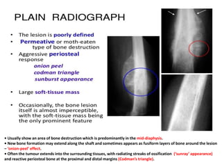 • Usually show an area of bone destruction which is predominantly in the mid-diaphysis.
• New bone formation may extend along the shaft and sometimes appears as fusiform layers of bone around the lesion
– ‘onion-peel’ effect.
• Often the tumour extends into the surrounding tissues, with radiating streaks of ossification (‘sunray’ appearance)
and reactive periosteal bone at the proximal and distal margins (Codman’s triangle).
 