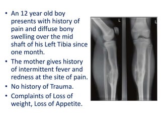 • An 12 year old boy
presents with history of
pain and diffuse bony
swelling over the mid
shaft of his Left Tibia since
one month.
• The mother gives history
of intermittent fever and
redness at the site of pain.
• No history of Trauma.
• Complaints of Loss of
weight, Loss of Appetite.
 