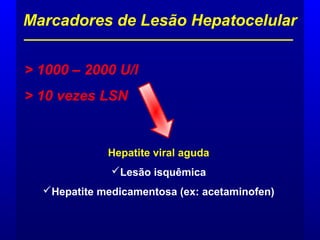 Marcadores de Lesão Hepatocelular
> 1000 – 2000 U/l
> 10 vezes LSN
Hepatite viral aguda
Lesão isquêmica
Hepatite medicamentosa (ex: acetaminofen)
 