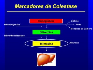 Marcadores de Colestase
Hemoglobina
Biliverdina
Bilirrubina
Hemeoxigenase
Globina
Ferro
Monóxido de Carbono
Biliverdina Redutase
Albumina
 