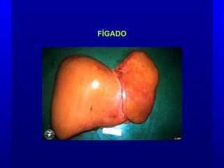 FÍGADO
 