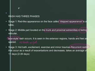 Rash Recticular 1- Fever and rash.pdfhhhhhhhhhhhhhhhhhhhh | PDF