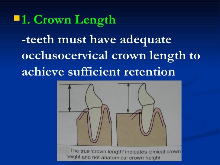 1. fixed partial denture finals1