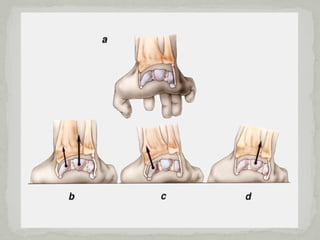 Comprehensive Overview of Distal Radius Fractures: Diagnosis ...