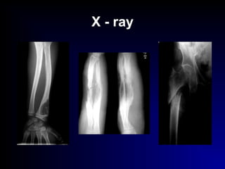 X - ray
 