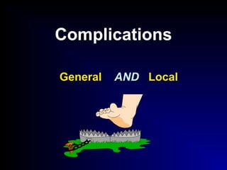 Complications
General AND Local
 