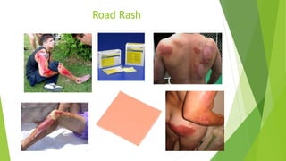 Geiger- Interdisplinary approach to wound management | PPTX
