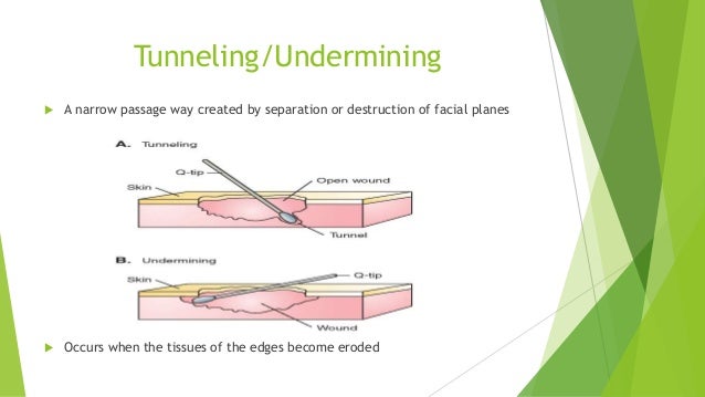 Geiger- Interdisplinary approach to wound management Geiger- Interdisplinary approach to wound management