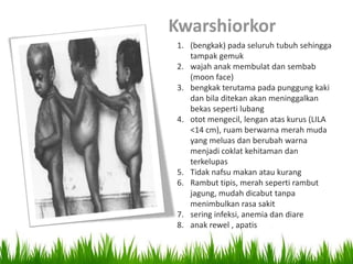 Kwarshiorkor
1. (bengkak) pada seluruh tubuh sehingga
   tampak gemuk
2. wajah anak membulat dan sembab
   (moon face)
3. bengkak terutama pada punggung kaki
   dan bila ditekan akan meninggalkan
   bekas seperti lubang
4. otot mengecil, lengan atas kurus (LILA
   <14 cm), ruam berwarna merah muda
   yang meluas dan berubah warna
   menjadi coklat kehitaman dan
   terkelupas
5. Tidak nafsu makan atau kurang
6. Rambut tipis, merah seperti rambut
   jagung, mudah dicabut tanpa
   menimbulkan rasa sakit
7. sering infeksi, anemia dan diare
8. anak rewel , apatis
 