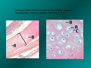 Cartílago hialino (mucha sustancia intercelular): tráquea, articulaciones, extremo costillas  Identifica A, B Y C 