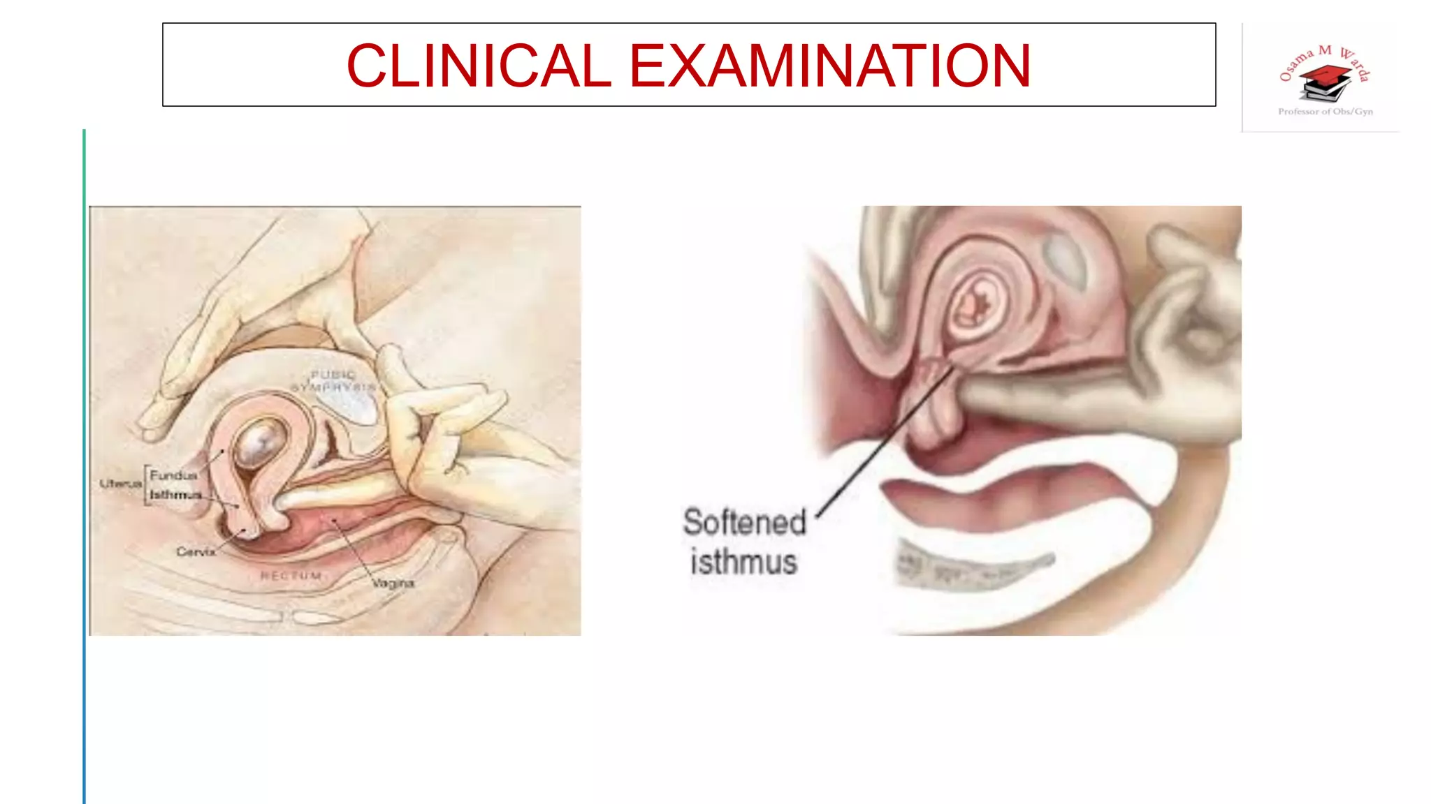 CLINICAL EXAMINATION
 
