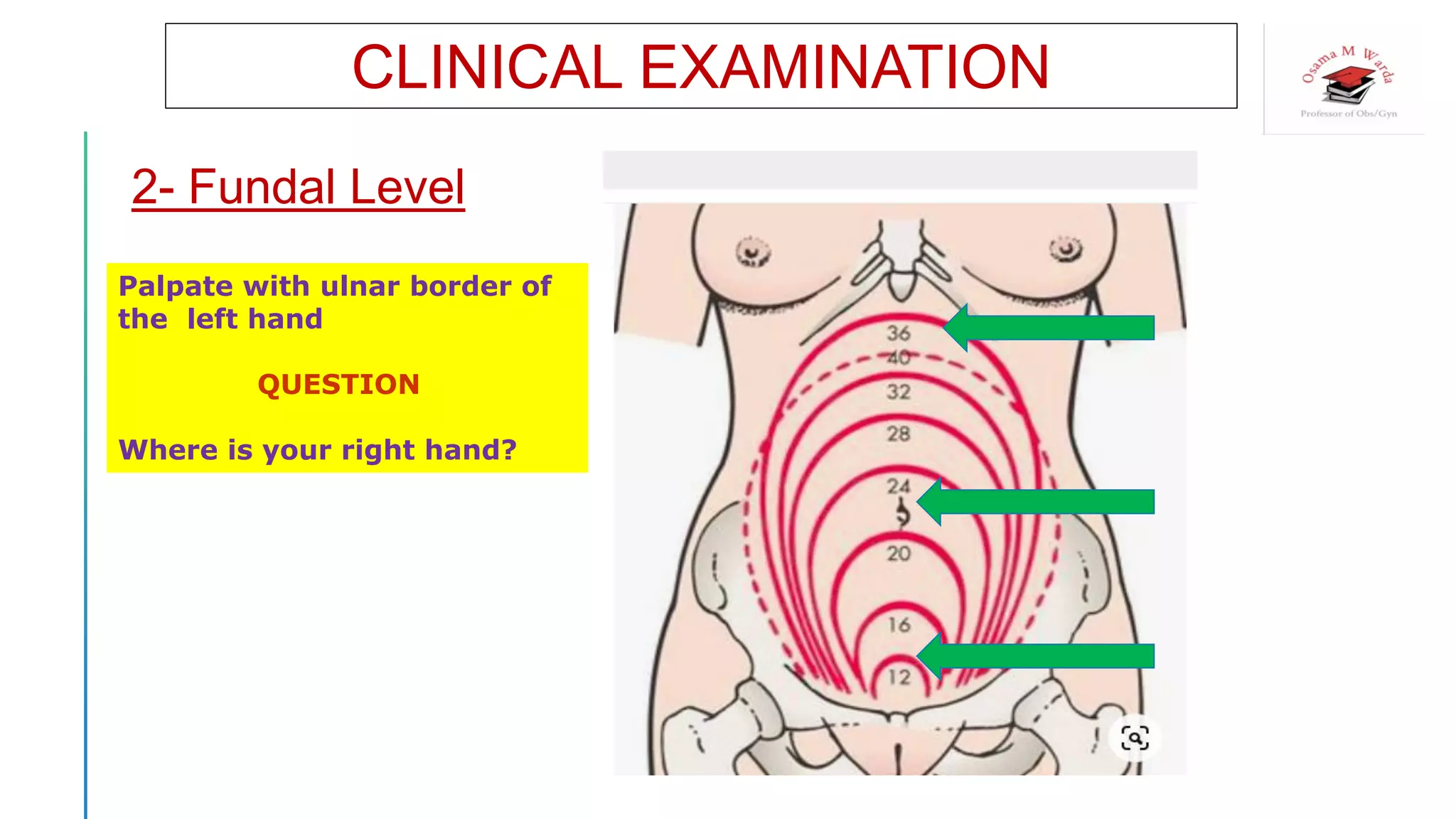 CLINICAL EXAMINATION
2- Fundal Level
Palpate with ulnar border of
the left hand
QUESTION
Where is your right hand?
 