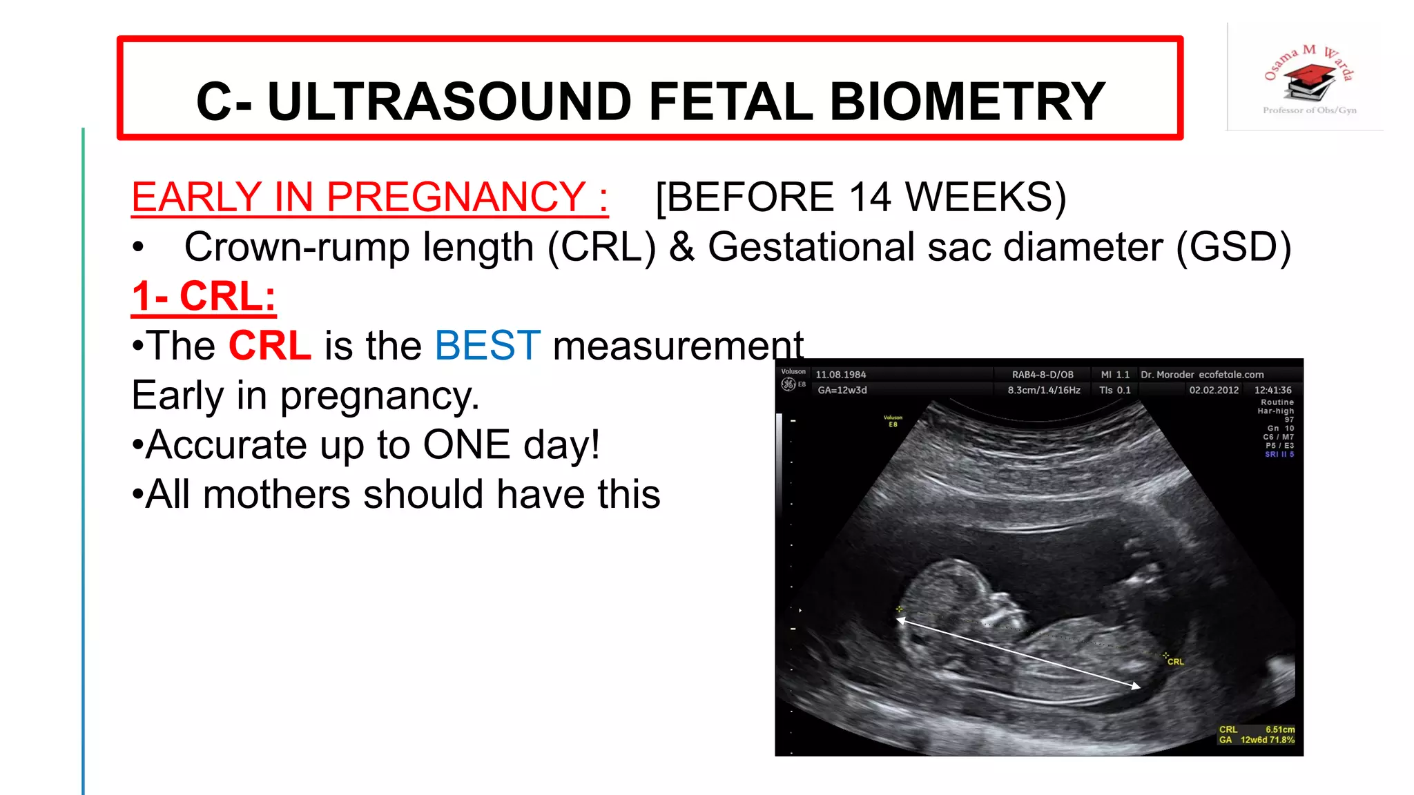 EARLY IN PREGNANCY : [BEFORE 14 WEEKS)
• Crown-rump length (CRL) & Gestational sac diameter (GSD)
1- CRL:
•The CRL is the BEST measurement
Early in pregnancy.
•Accurate up to ONE day!
•All mothers should have this
C- ULTRASOUND FETAL BIOMETRY
 