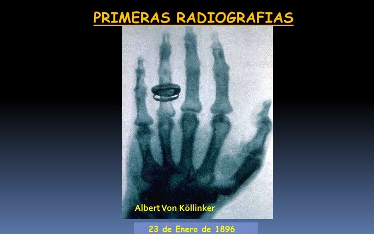 Resultado de imagen para Fundamentos de los exámenes radiográficos simples. Indicaciones y aplicaciones