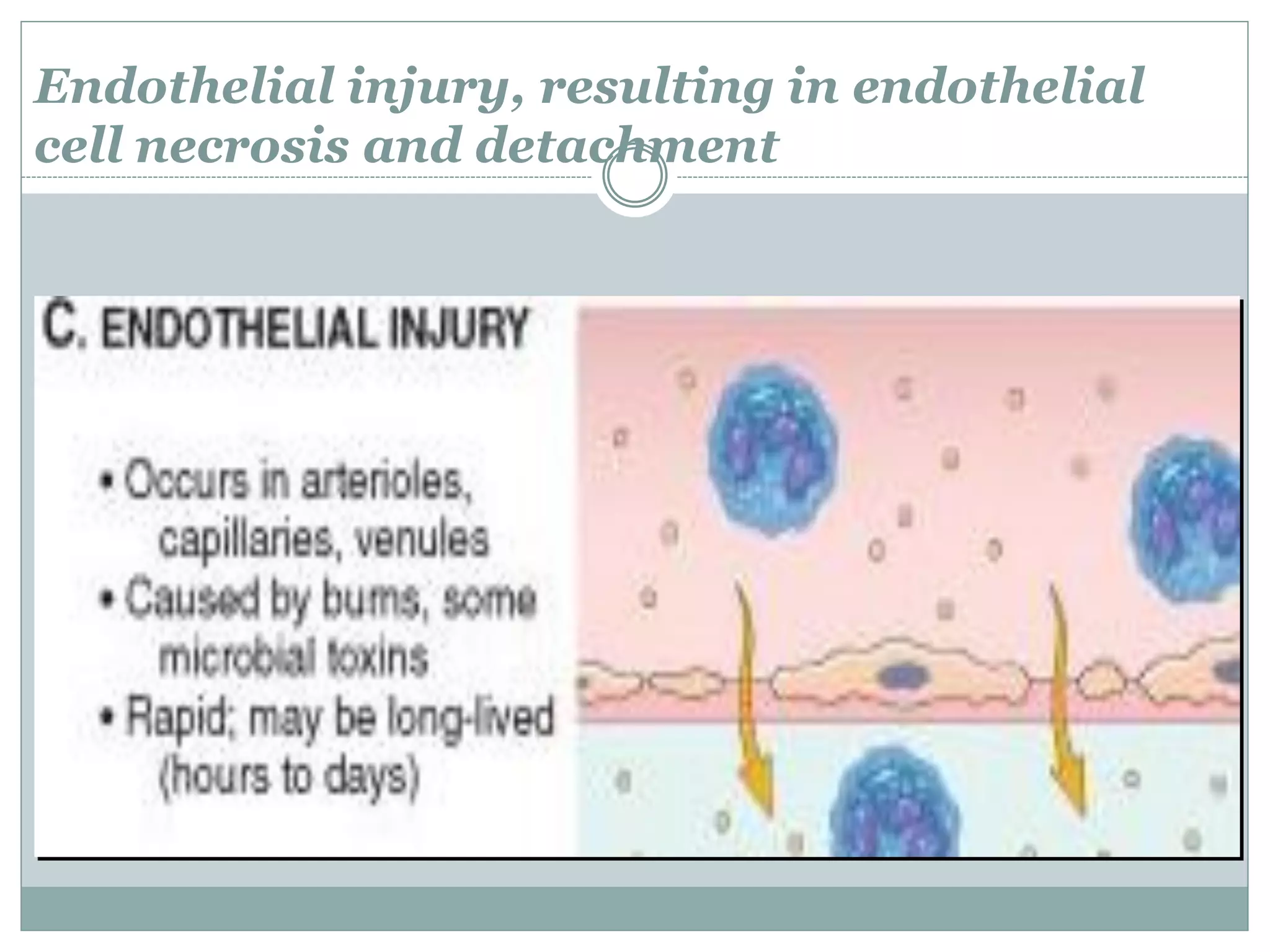 Endothelial injury, resulting in endothelial
cell necrosis and detachment
 