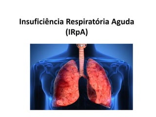 Insuficiência Respiratória Aguda
(IRpA)
 